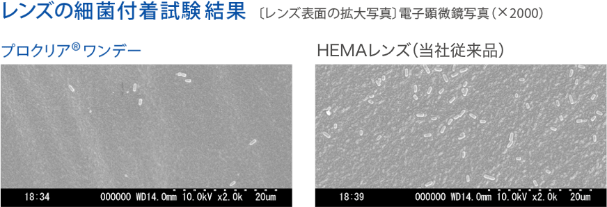 レンズの細菌不着試験結果